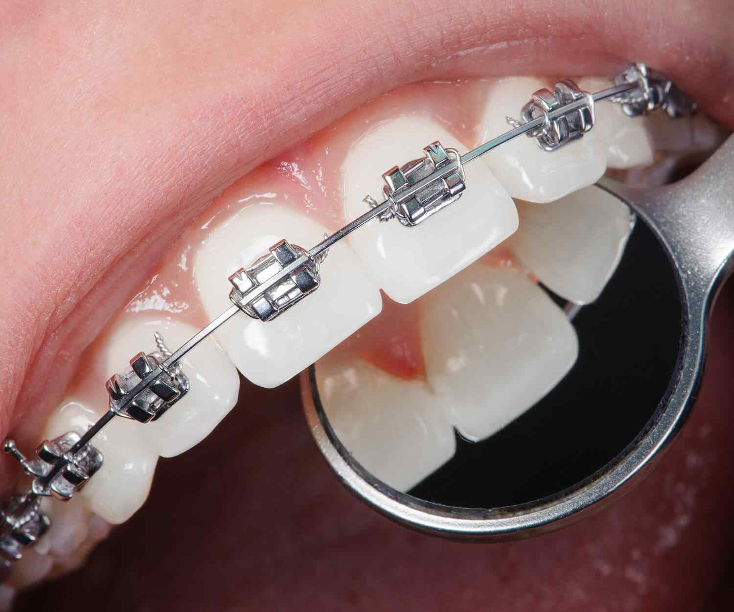 https://ocyra.co.uk/wp-content/uploads/2021/10/card_image_home_03-03.jpg